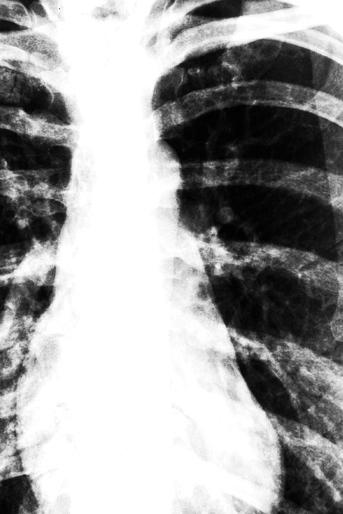 Skeleton Crop Top - POPRAGEOUS
 - 5